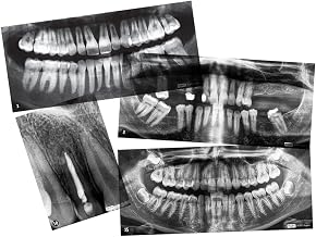 Roylco Real Dental X-Rays Educational Set - 15 Authentic Human Teeth Images with Chart & Guide, Shows Cavities, Braces, Sports Injuries & Development, Light Table Compatible, Ages 5+, 17 Pieces