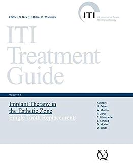 ITI Treatment Guide, Volume 1: Implant Therapy in the Esthetic Zone for Single-tooth Replacements by U. Belser (2007-01-30)