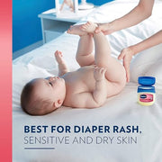 Vaseline 13 Ounce (Pack of 4) / Baby / White Lotions