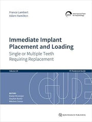 Immediate Implant Placement and Loading: Single or Multiple Teeth Requiring Replacement (ITI Treatment Guides, 14)