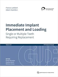 Immediate Implant Placement and Loading: Single or Multiple Teeth Requiring Replacement (ITI Treatment Guides, 14)