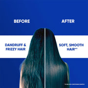 Smooth and Silky 2-in-1 Anti Dandruff Shampoo + Conditioner (180ml) by Head & Shoulders – 1 Count (Pack of 1), Model 82272336