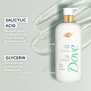 Dove 18.5 Fl Oz (Pack of 4) / White / Acne Clearing Body Washes