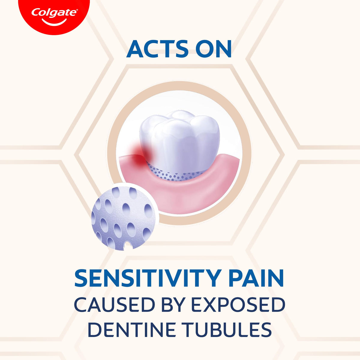 Sensitive Toothpaste with Clove Oil by Colgate – 1.7 Ounce (Pack of 1), Model IN00697A
