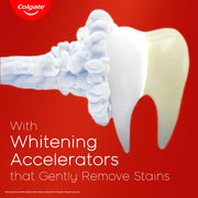 Visible White Toothpaste (50g) Teeth Whitening Starts in 1 Week by Colgate – 1.7 Ounce (Pack of 1), Model 1607778