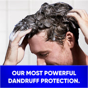 Clinical Strength Advanced Oil Control Anti-Dandruff Shampoo by Head & Shoulders – 13.5 Fl Oz (Pack of 6), 블루., Pack of 6, Model 030772161647