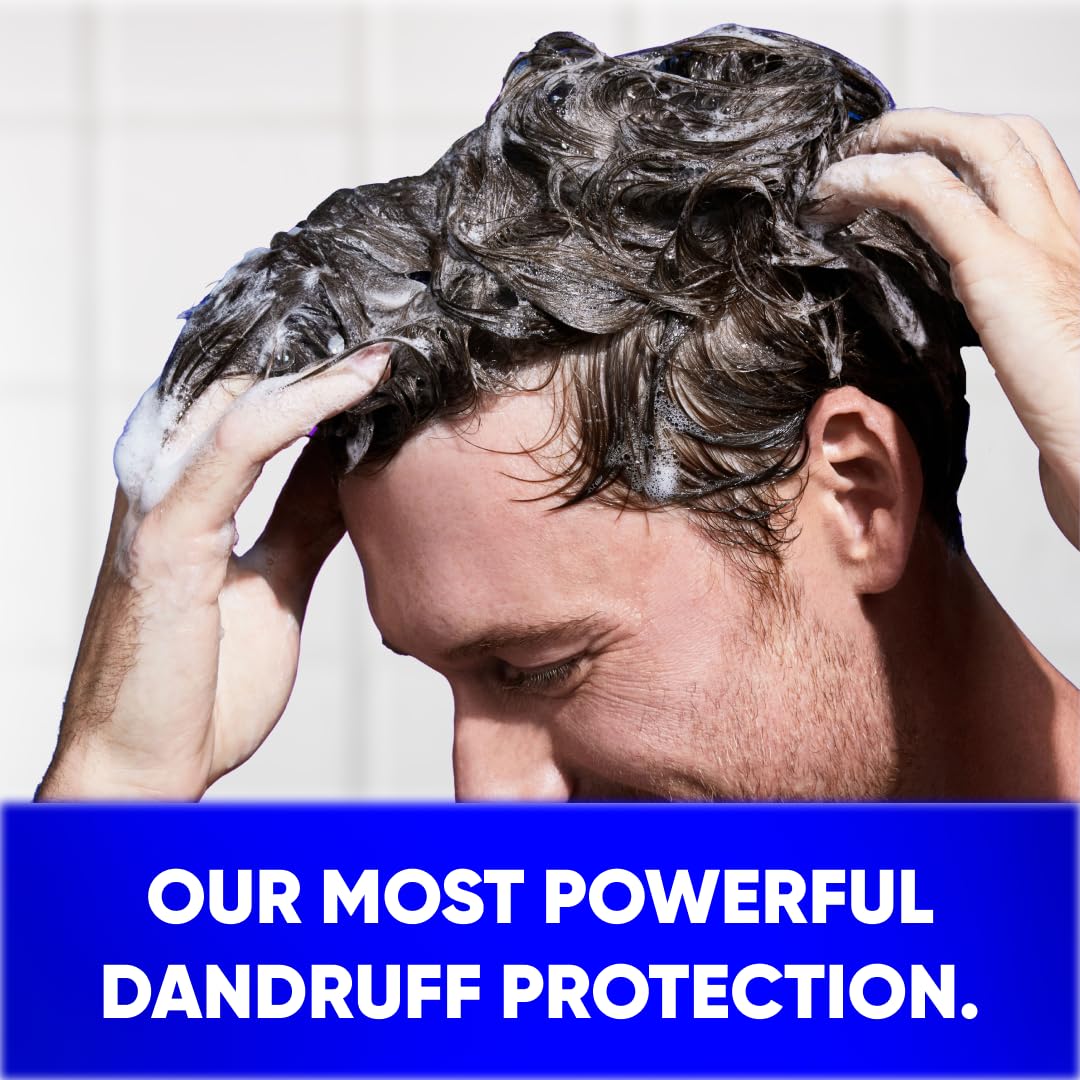 Clinical Strength Advanced Oil Control Anti-Dandruff Shampoo by Head & Shoulders – 13.5 Fl Oz (Pack of 6), 블루., Pack of 6, Model 030772161647