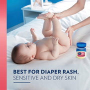 Vaseline 13 Ounce (Pack of 4) / Baby / White Lotions