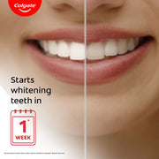 Visible White Toothpaste (50g) Teeth Whitening Starts in 1 Week by Colgate – 1.7 Ounce (Pack of 1), Model 1607778