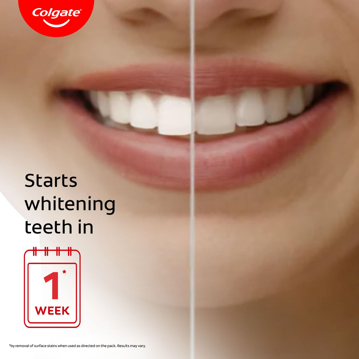 Visible White Toothpaste (50g) Teeth Whitening Starts in 1 Week by Colgate – 1.7 Ounce (Pack of 1), Model 1607778