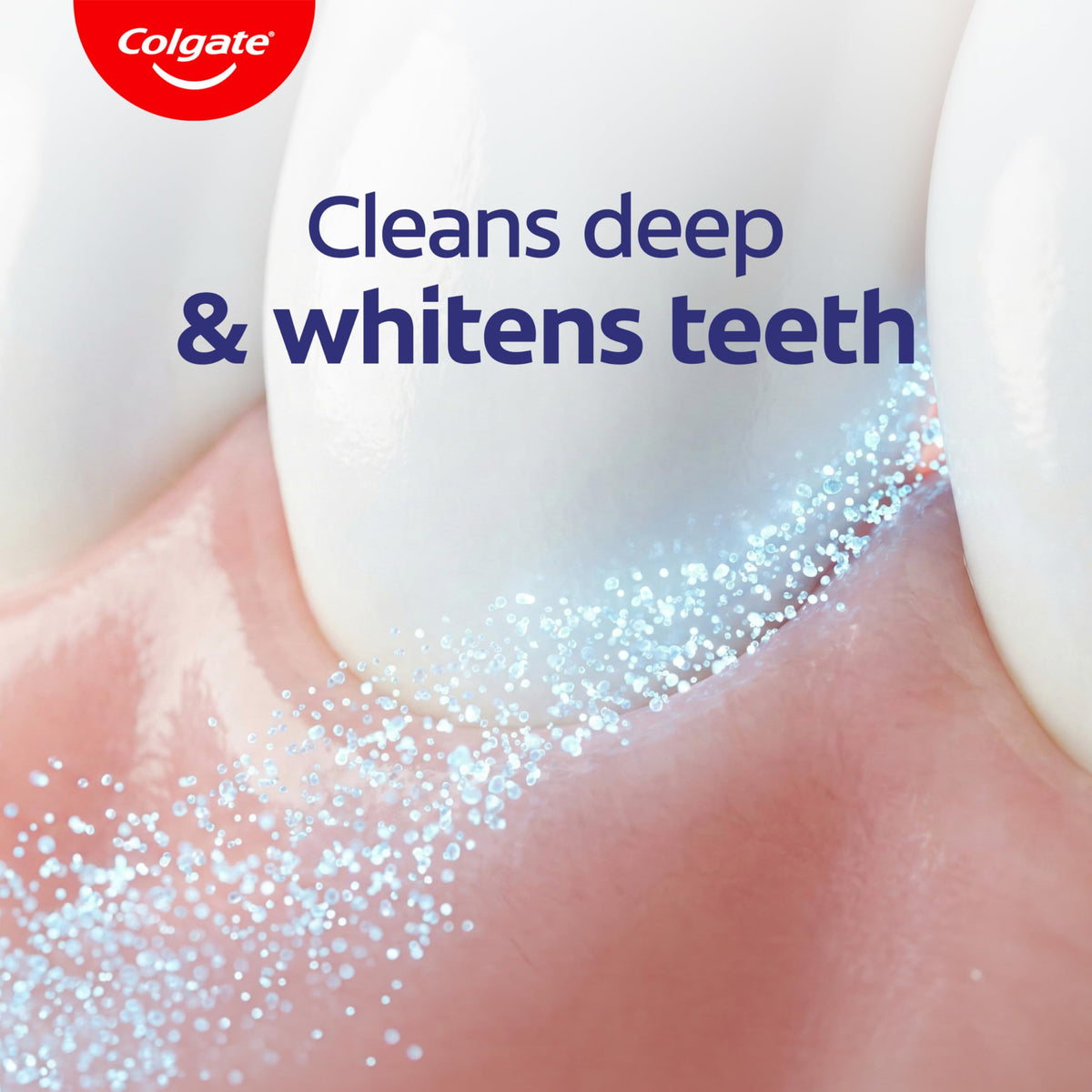 Baking Soda and Peroxide Whitening Toothpaste Gel by Colgate – 6 Ounce (Pack of 3), Frosty Mint, Pack of 3, Model US06842A