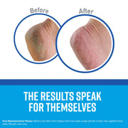 Healthy Feet Foot Cream Tube (4 Pack) by O'Keeffe's – 3 Ounce (Pack of 4), Pack of 4, Model K0280004-4