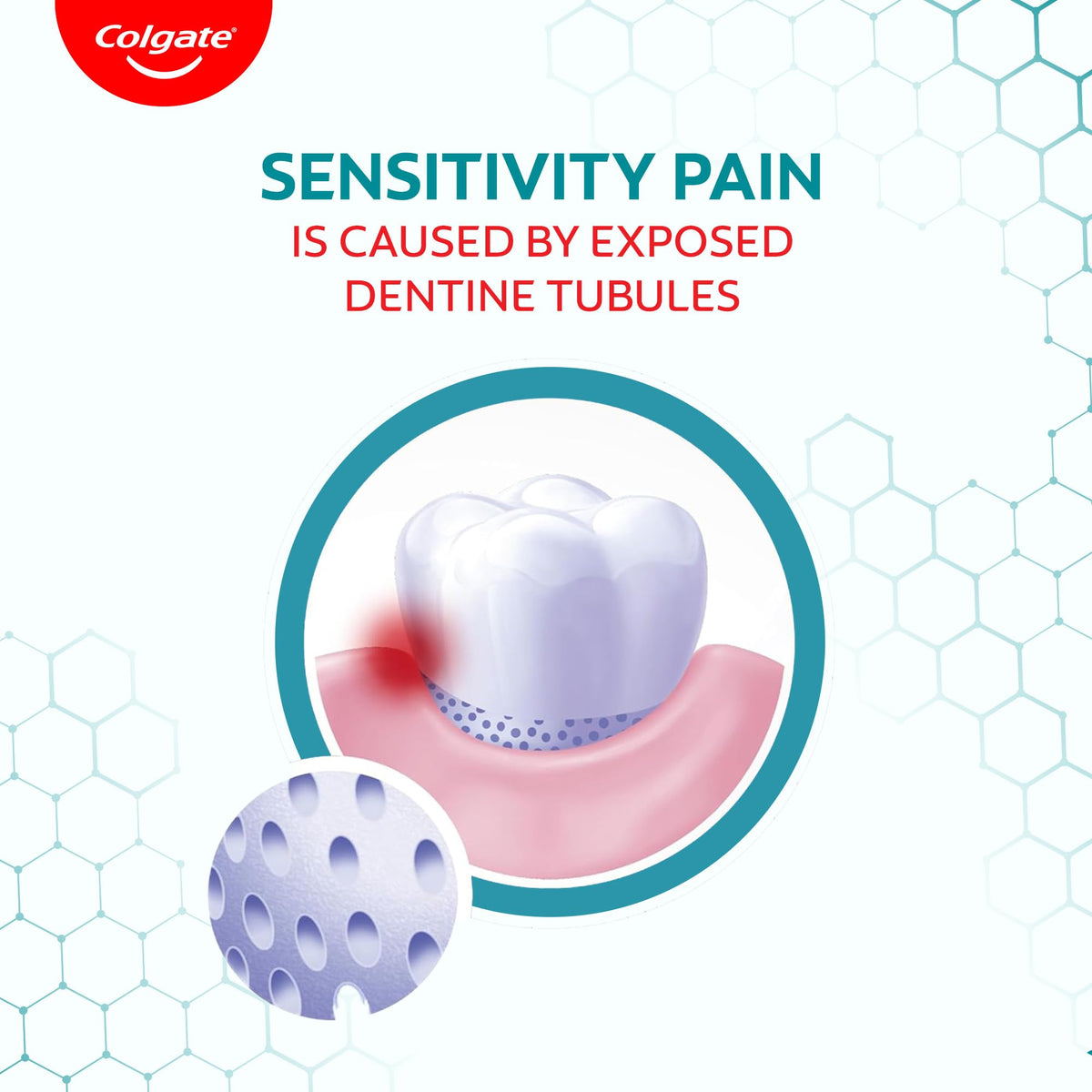 Toothpaste Sensitive Plus - 70g (Sensitivity) by Colgate – 2.46 Ounce (Pack of 1), Model 1601240