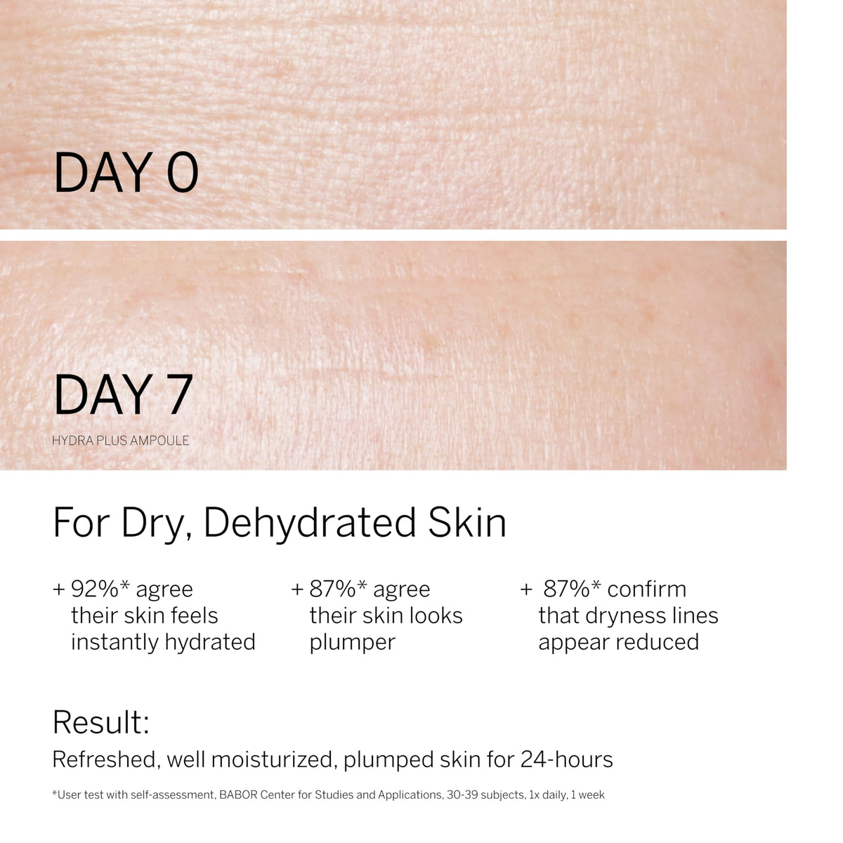Hydra Plus & Active Purifier Ampoule Concentrate Bundle by BABOR – Commercial Grade