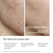 Hydra Plus & Active Purifier Ampoule Concentrate Bundle by BABOR – Commercial Grade